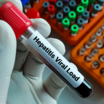 Julho Amarelo começa com alerta para hepatites virais: quem deve fazer o teste e como se proteger