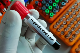 Julho Amarelo começa com alerta para hepatites virais: quem deve fazer o teste e como se proteger