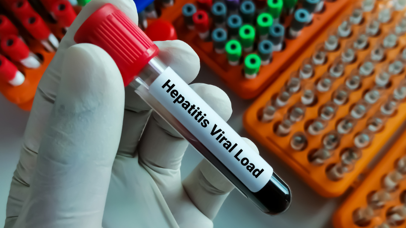 Julho Amarelo começa com alerta para hepatites virais: quem deve fazer o teste e como se proteger